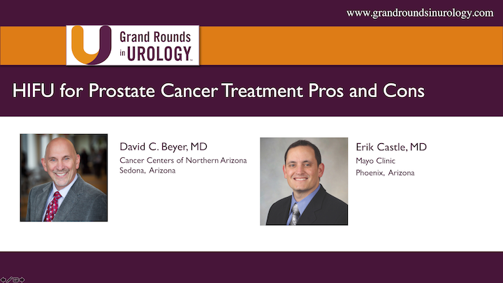 HIFU For Prostate Cancer Treatment Pros And Cons