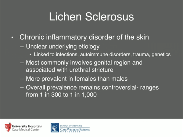 Chris Gonzalez Management Of Lichen Sclerosus Related Urethral Strictures