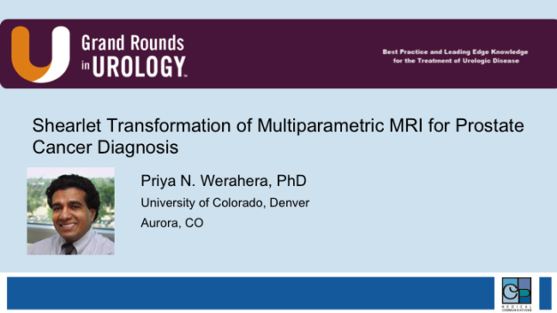 Shearlet Transformation of Multiparametric MRI for Prostate Cancer Diagnosis
