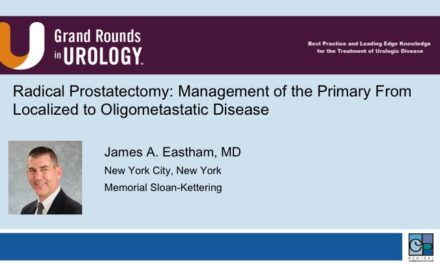 Radical Prostatectomy: Management of the Primary From Localized to Oligometastatic Disease