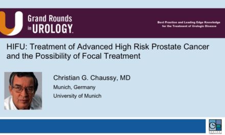 HIFU: Treatment of Advanced High Risk Prostate Cancer and the Possibility of Focal Treatment