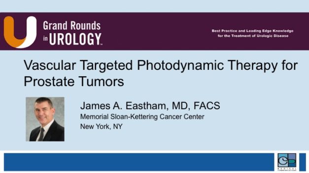 Vascular Targeted Photodynamic Therapy for Prostate Tumors