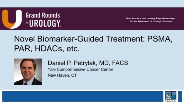 Novel Biomarker-Guided Treatment: PSMA, PAR, HDACs, etc.