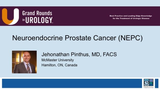 Neuroendocrine Prostate Cancer (NEPC)