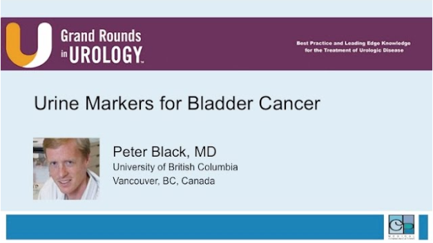 Urine Markers for Bladder Cancer