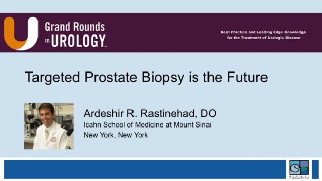 Targeted Prostate Biopsy Is the Future