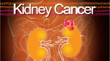 Kidney Cancer Journal | Volume 4, Issue 3 | Grand Rounds in Urology