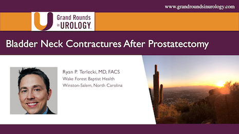 Bladder Neck Contractures After Prostatectomy