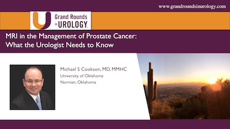 MRI in the Management of Prostate Cancer: What Urologists Need to Know
