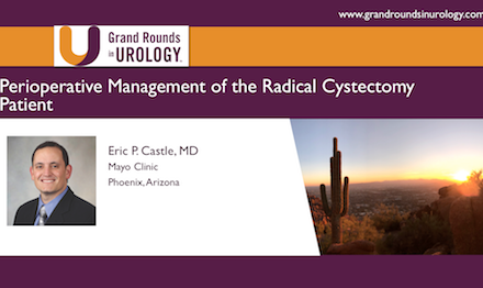 Perioperative Management of the Radical Cystectomy Patient