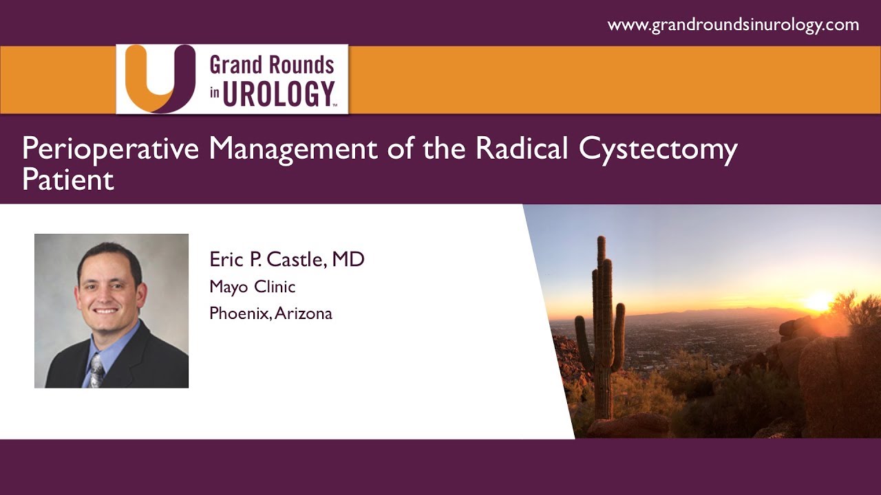 Dr. Castle Perioperative Management of the Radical Cystectomy Patient