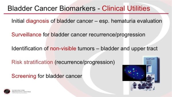 Dr. Peter Black | Urine Markers For Bladder Cancer | The Ideal Marker