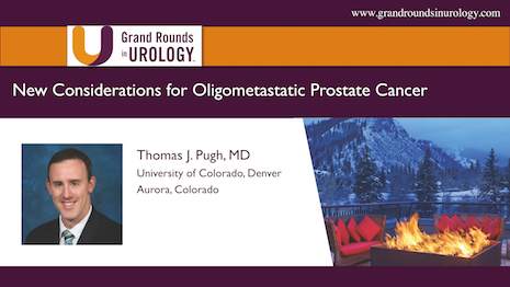 New Considerations for Oligometastatic Prostate Cancer
