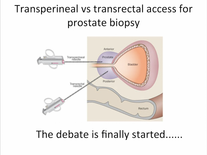 What happens after prostate biopsy