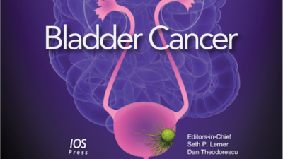 Metastatic cancer of the bladder