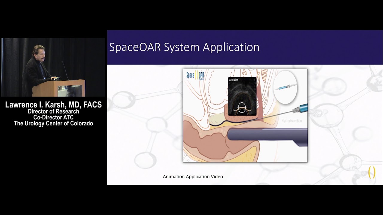 SpaceOAR Hydrogel | Prostate-Rectum Spacing in Radiation Therapy