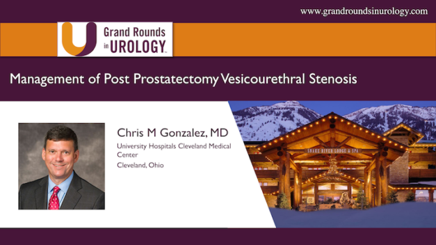 Management of Post Prostatectomy Vesicourethral Stenosis