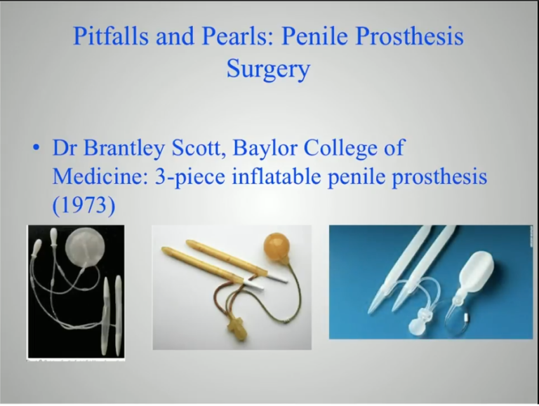 Brian S. Christine Pitfalls and Pearls of Penile Prosthesis Surgery