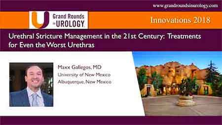 Urethral Stricture Management in the 21st Century: Treatments for Even the Worst Urethras