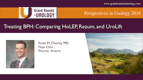 Treating BPH: Comparing HoLEP, Rezum, and Urolift