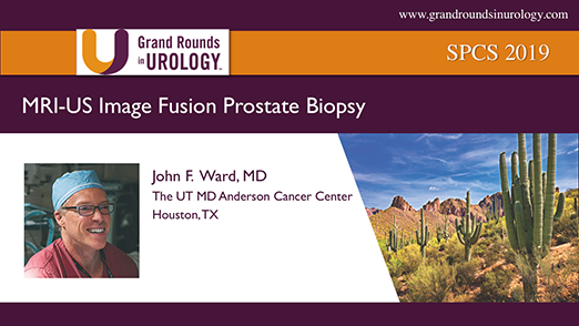 MRI-US Image Fusion Prostate Biopsy