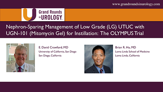 Nephron-Sparing Management of Low Grade UTUC with UGN-101 for Instillation-The OLYMPUS Trial