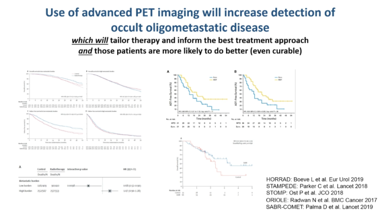 Radiation Oncology Perspective On Oligometastatic PCa Treatment | Video