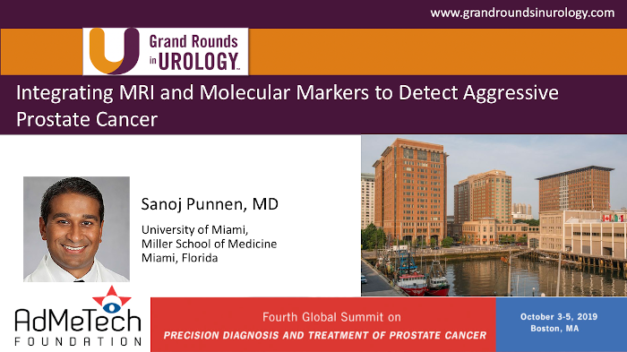 Integrating MRI and Molecular Markers to Detect Aggressive Prostate Cancer