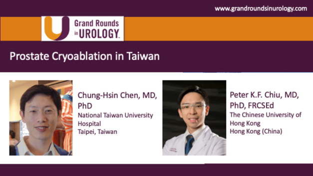 Prostate Cryoablation in Taiwan