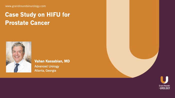 Case Study on HIFU for Prostate Cancer | Video | Dr. Kassabian