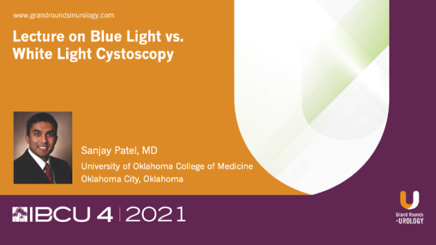 Blue Light vs. White Light Cystoscopy for NMIBC