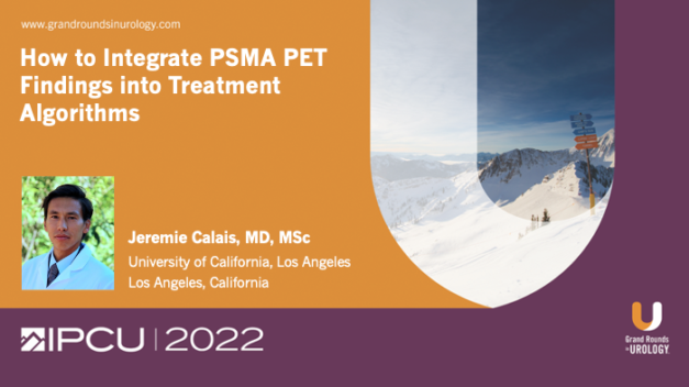 How to Integrate PSMA PET Findings Into Treatment Algorithms