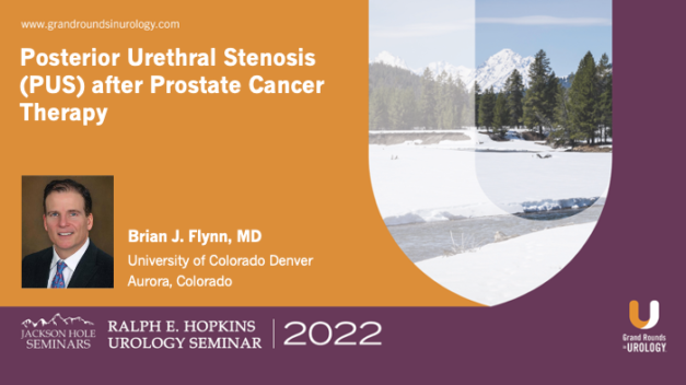 Posterior Urethral Stenosis (PUS) After Prostate Cancer Therapy