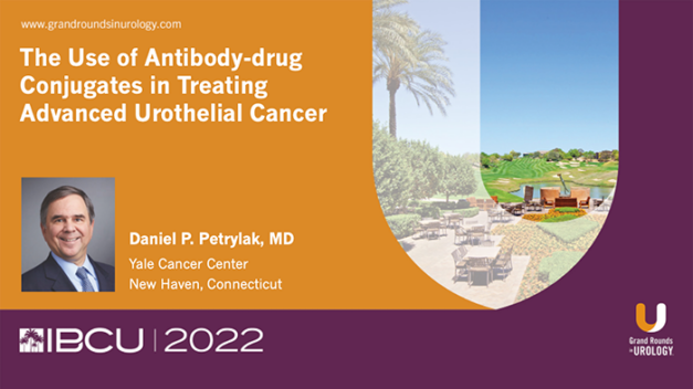 The Use of Antibody-drug Conjugates in Treating Advanced Urothelial Cancer