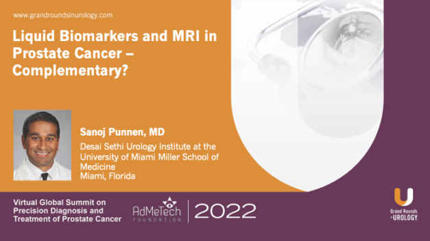 Liquid Biomarkers and MRI in Prostate Cancer – Complementary?