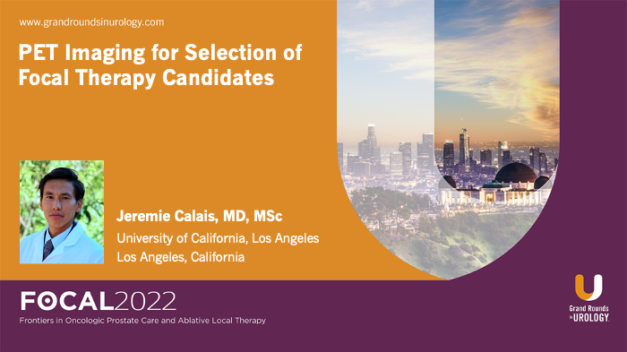 PET Imaging for Selection of Focal Therapy Candidates