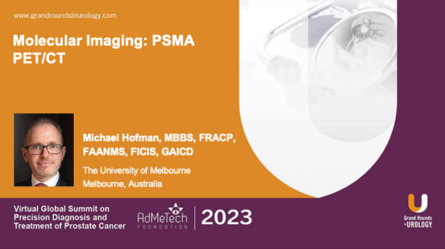 Molecular Imaging: PSMA PET/CT