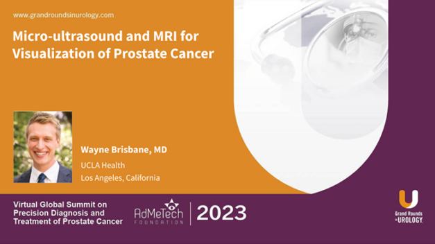 Micro-ultrasound and MRI for Visualization of Prostate Cancer