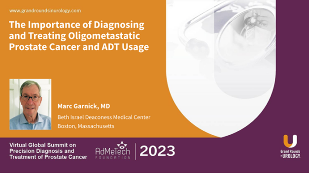 The Importance of Diagnosing and Treating Oligometastatic Prostate Cancer and ADT Usage