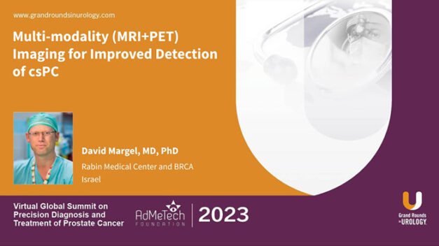 Multi-modality (MRI+PET) Imaging for Improved Detection of csPC