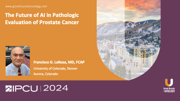 The Future of AI in Pathologic Evaluation of Prostate Cancer