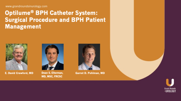 Optilume® BPH Catheter System: Surgical Procedure and BPH Patient Management