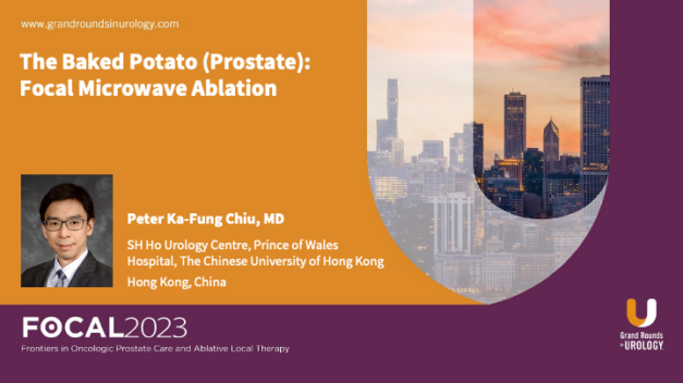 The Baked Potato (Prostate): Focal Microwave Ablation