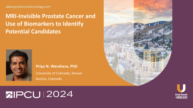 MRI-Invisible Prostate Cancer and Use of Biomarkers to Identify Potential Candidates