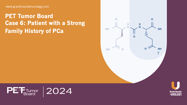 PET Tumor Board Case 6: Patient with a Strong Family History of PCa