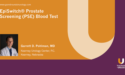 EpiSwitch® Prostate Screening (PSE) Blood Test