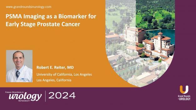 PSMA Imaging as a Biomarker for Early Stage Prostate Cancer