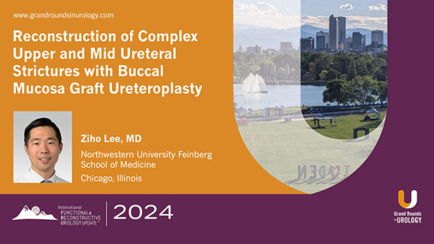 Reconstruction of Complex Upper and Mid Ureteral Strictures with Buccal Mucosa Graft Ureteroplasty