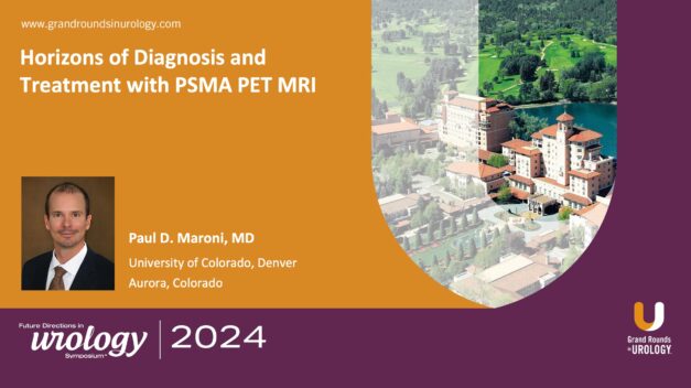 Horizons of Diagnosis and Treatment with PSMA PET MRI