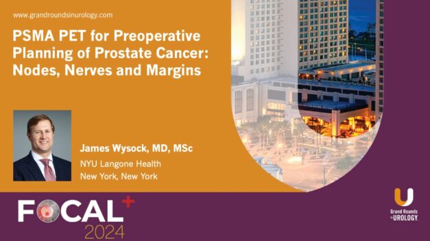 PSMA PET for Preoperative Planning of Prostate Cancer: Nodes, Nerves and Margins